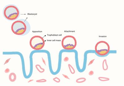 Recurrent implantation failure: A comprehensive summary from etiology to treatment